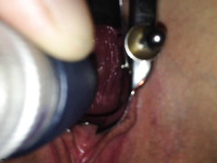 Парень через вагинальный расширитель рассматривает манду благоверной