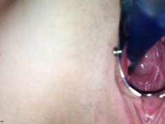 Парень через вагинальный расширитель рассматривает манду благоверной