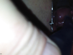 Парень через вагинальный расширитель рассматривает манду благоверной